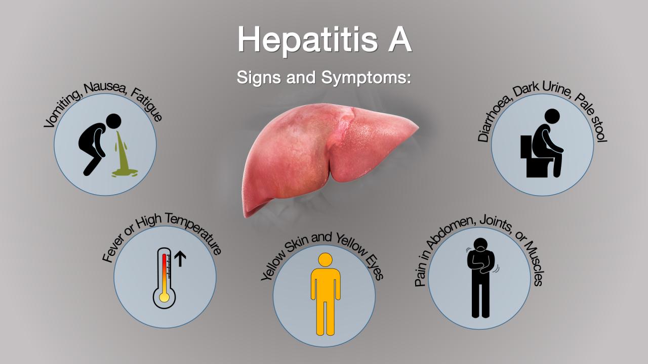 Diagnosis management and treatment of hepatitis c an update